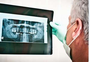 dental implants costa rica