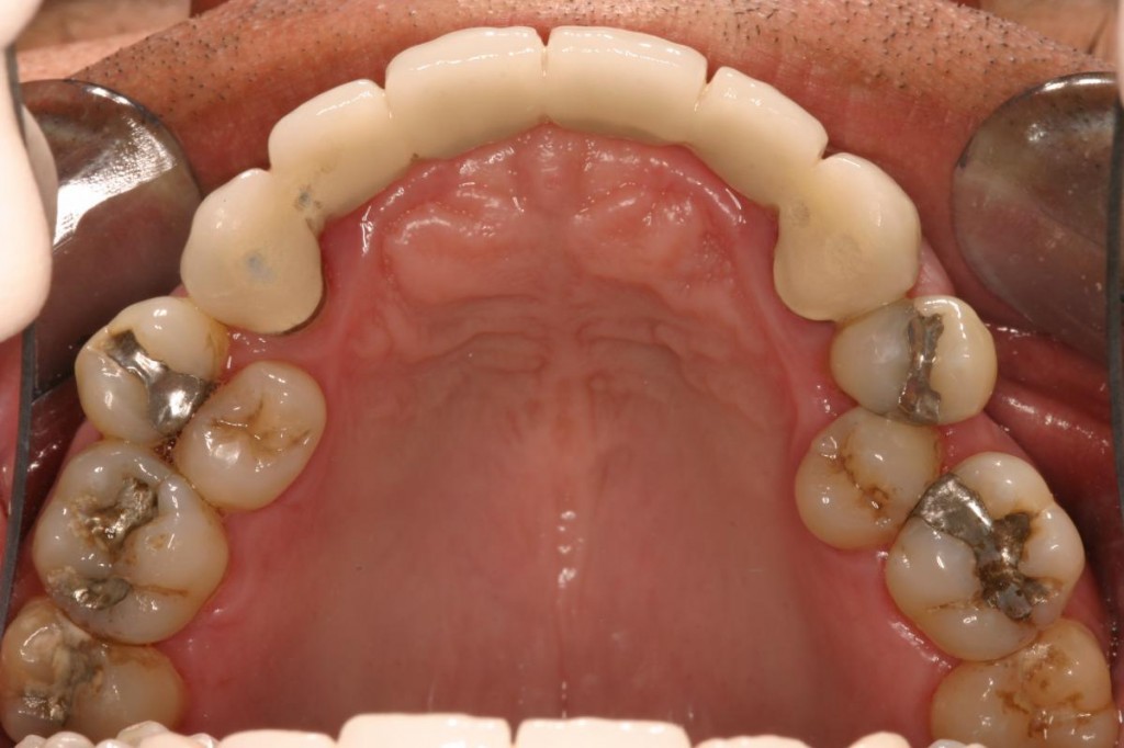 Major Dental Procedures Performed in CR The Costa Rican Times