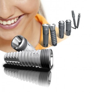 affordable dental implants