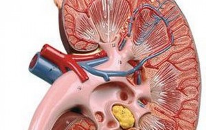 kidney trafficking costa rica 1