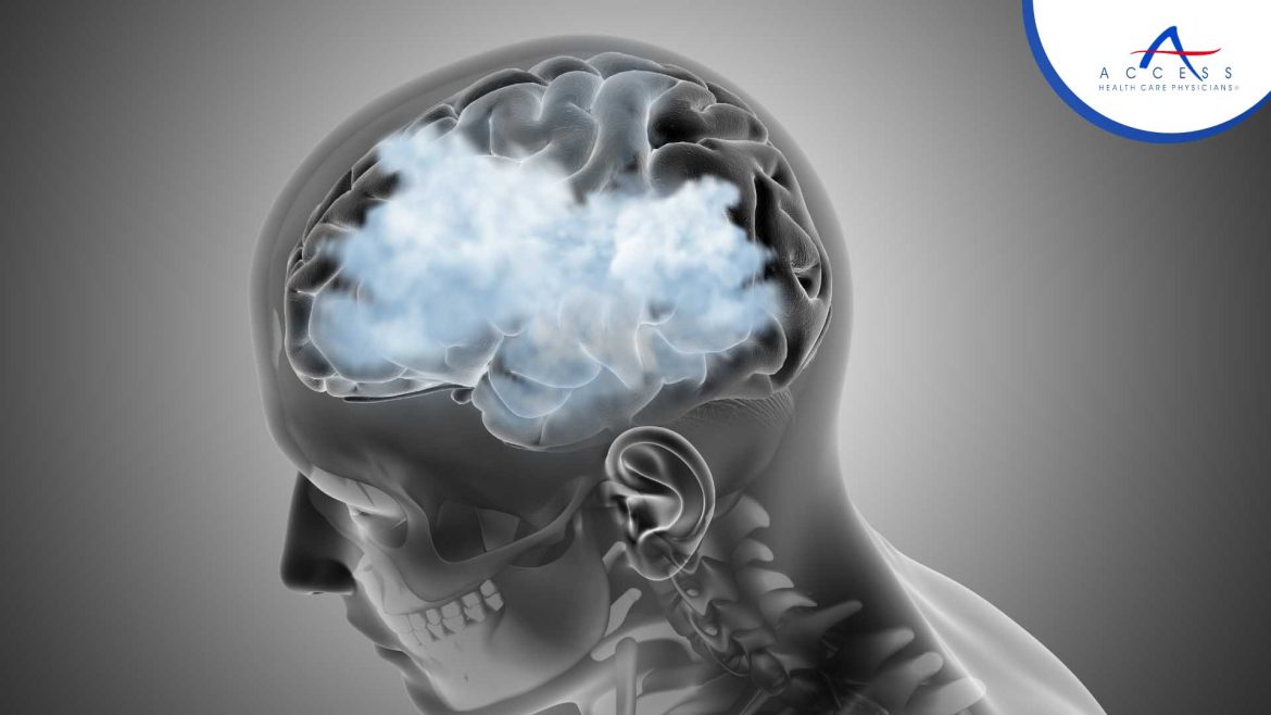 Overcoming Brain Fog: Effective Strategies to Clear Mental Haze and Boost Focus