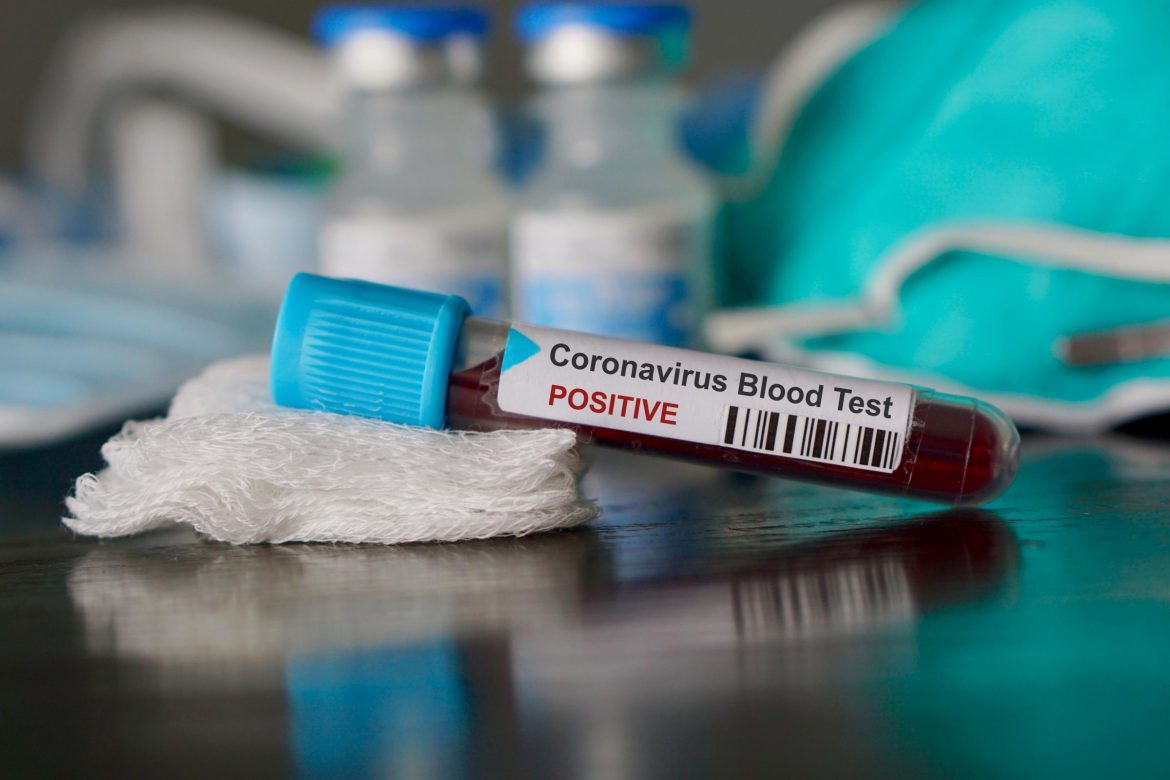 Costa Rica Using the Blood of Coronavirus Patients to Try to Find a Treatment
